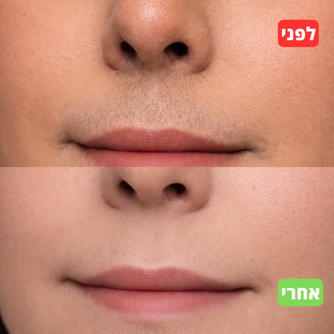 סרום טבעי להאטת צמיחת שיער - alora