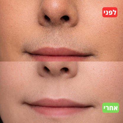 סרום טבעי להאטת צמיחת שיער - alora