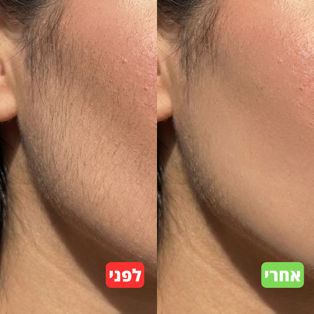 סרום טבעי להאטת צמיחת שיער - alora